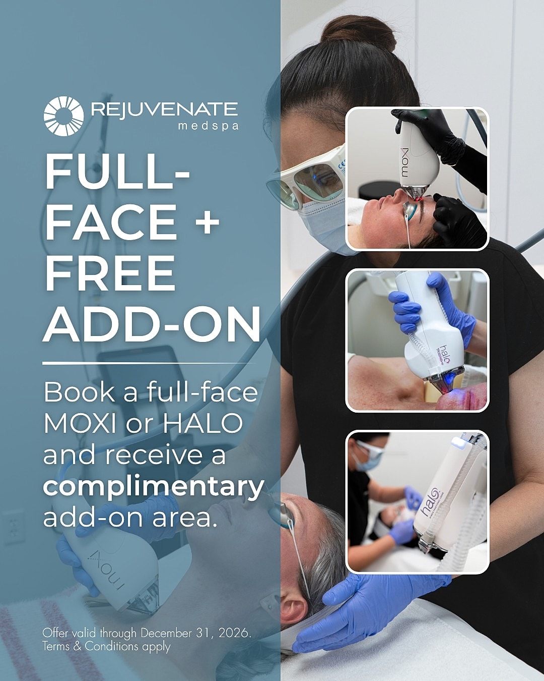 Medspa promotion for full-face treatment and add-on.