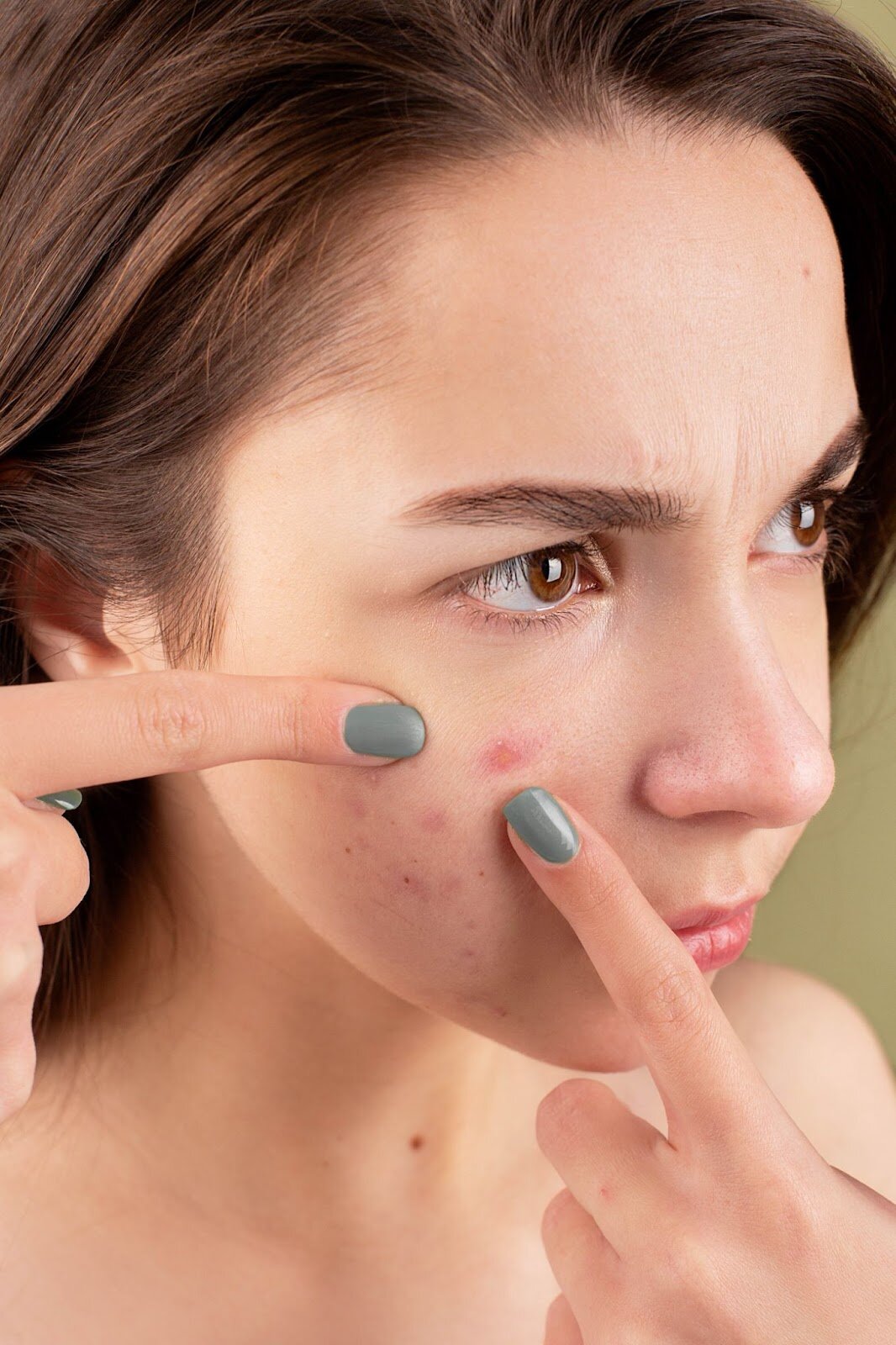 Sensitive & Problematic Skin Solutions